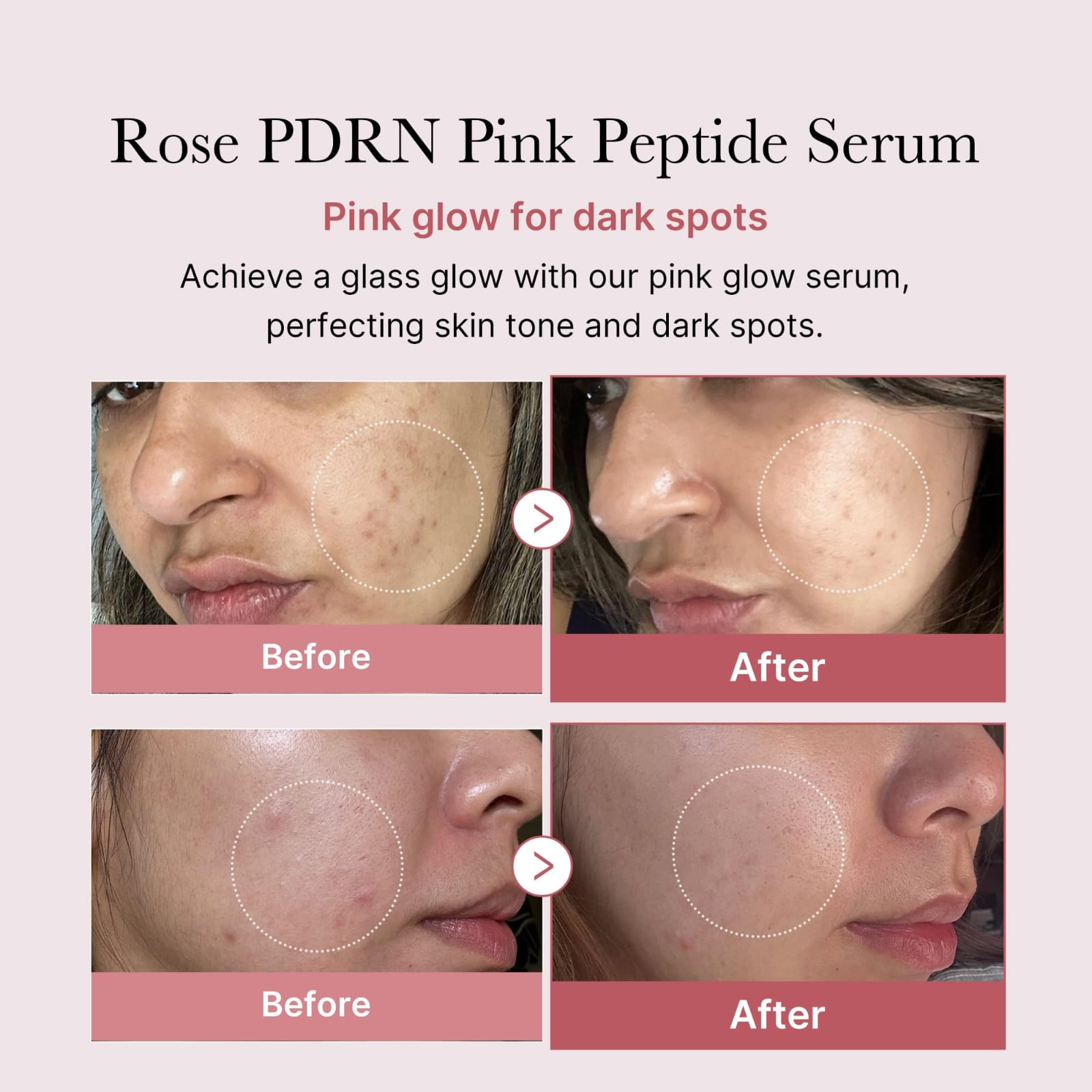 Medicube PDRN Pink Peptide Serum 