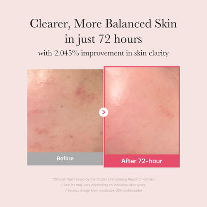 Medicube TXA Niacinamide 15 Serum - GlossyGlams